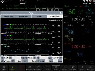 Full waveform