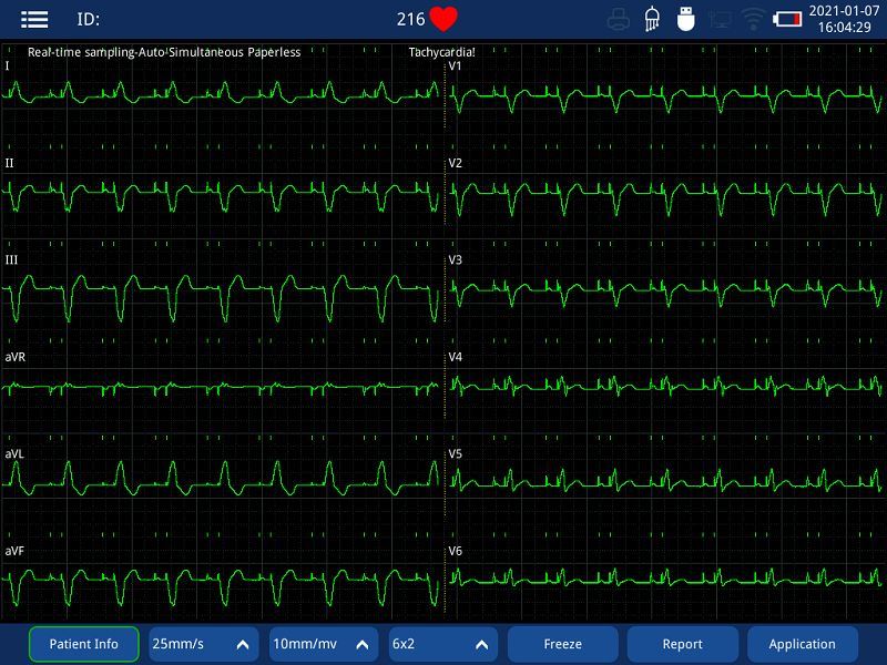 12 channel electrocardiograph machine with printer(001)